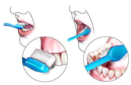 สุขภาพช่องปาก การแปรงฟัน
